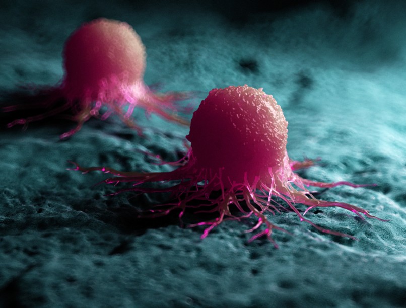 prosztatarák, enzim, enzimgátlás, daganat