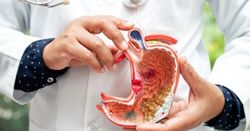  Gyomorrák: melyik stádium mit jelent, és milyen életkilátásokat jelez? 