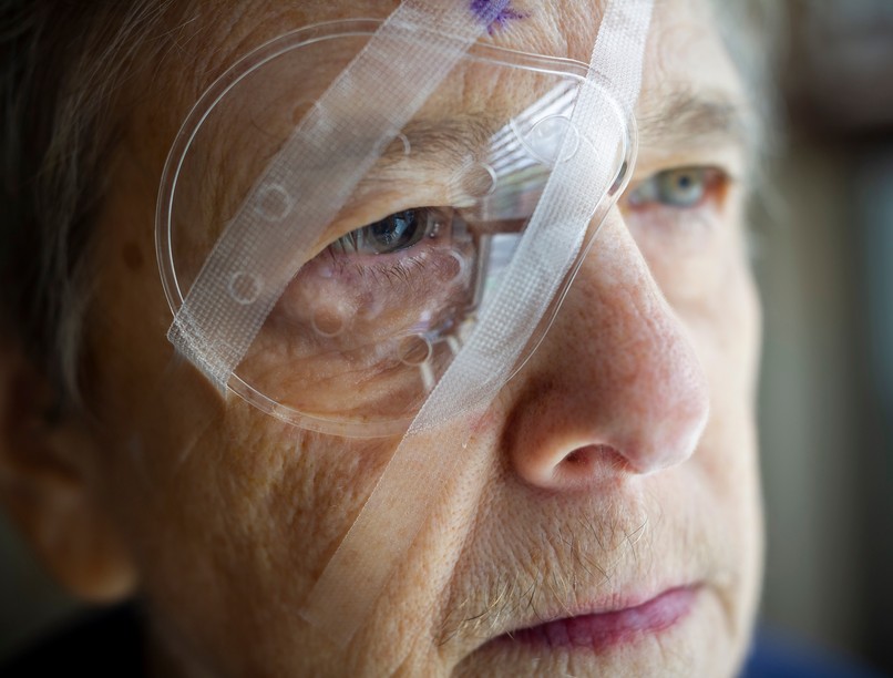 szürkehályog műtét után mire vigyázzunk