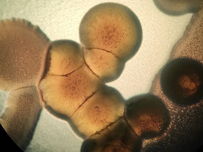 Halálos szuperbaktériumot fedeztek fel, amely orvosi műanyagon lakmározik című cikk nyitóképe