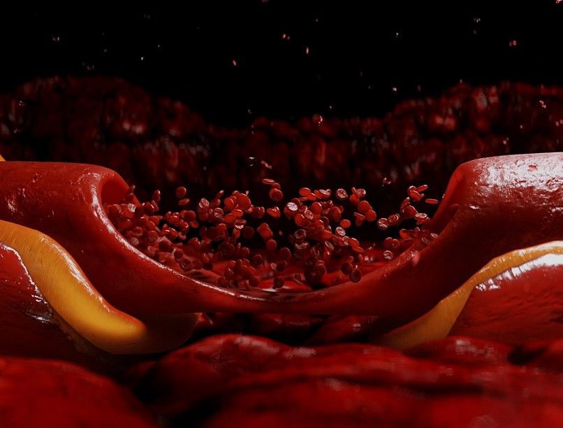 magas koleszterin ellen sztatin gyógyszer hatás mellékhatás