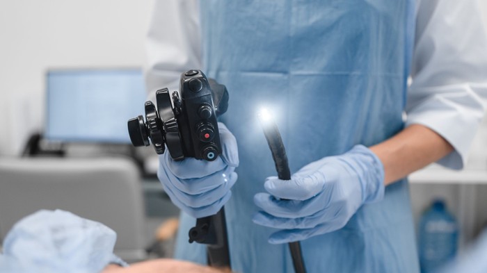 Milyen érzés a gyomortükrözés? Amitől tartanak, és ami valójában történik című cikk nyitóképe