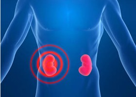 Policisztás vesebetegség