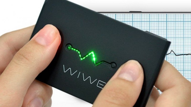 A mobil EKG sok sportoló életét mentheti meg