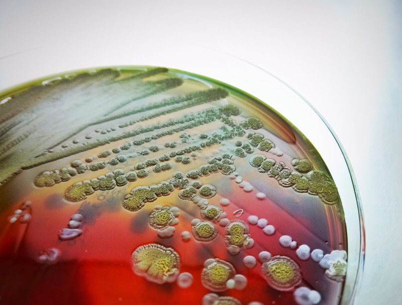 fulmináns szepszis oka tünete orvos válaszol