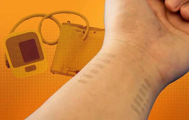 Vérnyomásmérés ideiglenes tetoválással - egy hétig méri az adatokat