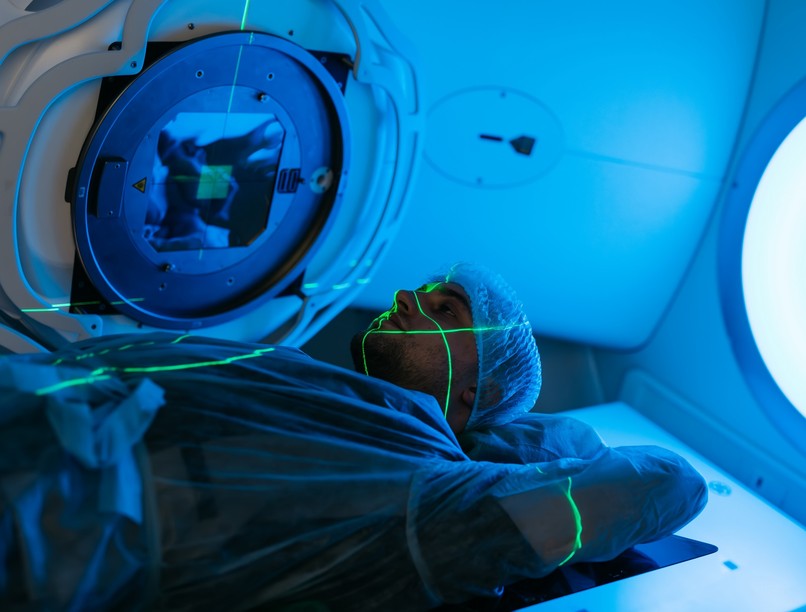 sugárkezelés hatása mellékhatásai daganat