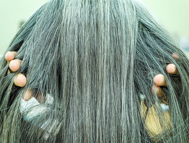 őszülés mit jelent mi hatékony ellene