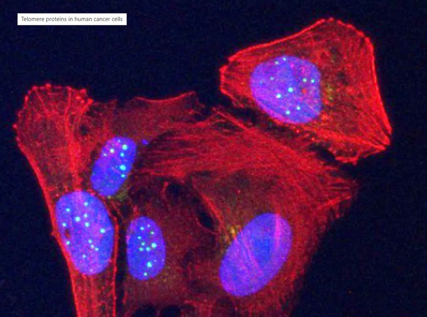 A VR fehérje (zöld gömbök) a sejtmagokban (kék oválisok) felhalmozódva látható emberi csontritkulásos rákos sejtekben. 