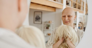  Kemoterápia és hajhullás - ezek a válaszok a betegek leggyakoribb kérdéseire 