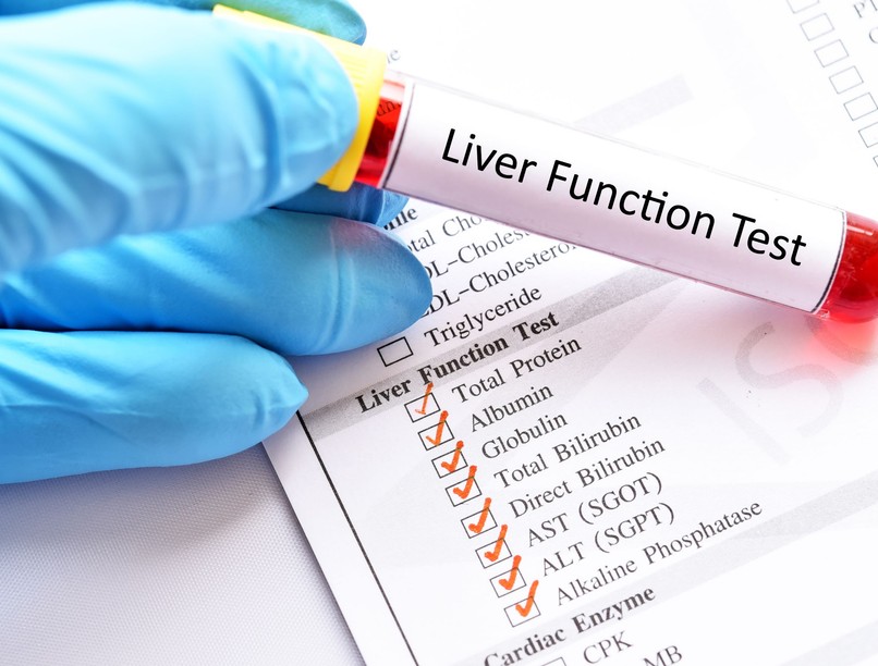 vérvétel máj labor teszt ALT GGT AST ALP