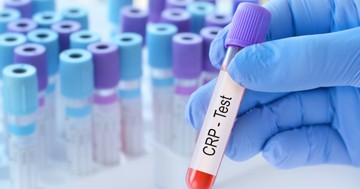 Egy szám a leleten, ami sokat elárul: miért lehet magas a CRP?