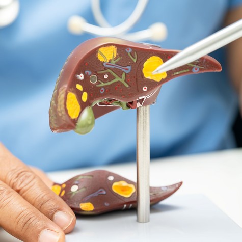 A tudósok figyelmeztetnek: ez a két tényező együtt súlyosan károsíthatja a májat című cikk nyitóképe