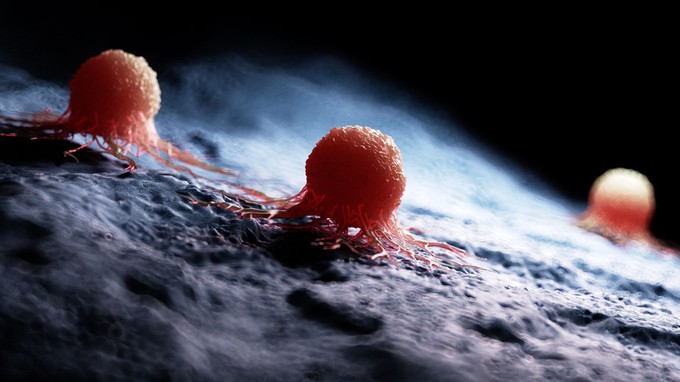 Így készítik elő az áttéteket a daganatsejtek című cikk nyitóképe