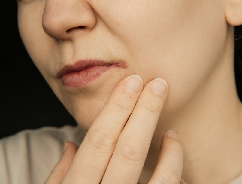 berepedezett szájzug, tápanyaghiány, gyógymódok, fertőzés