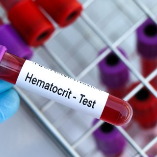 Hematokrit a vérképben: ezt jelenti, ha túl magas vagy túl alacsony az érték című cikk nyitóképe