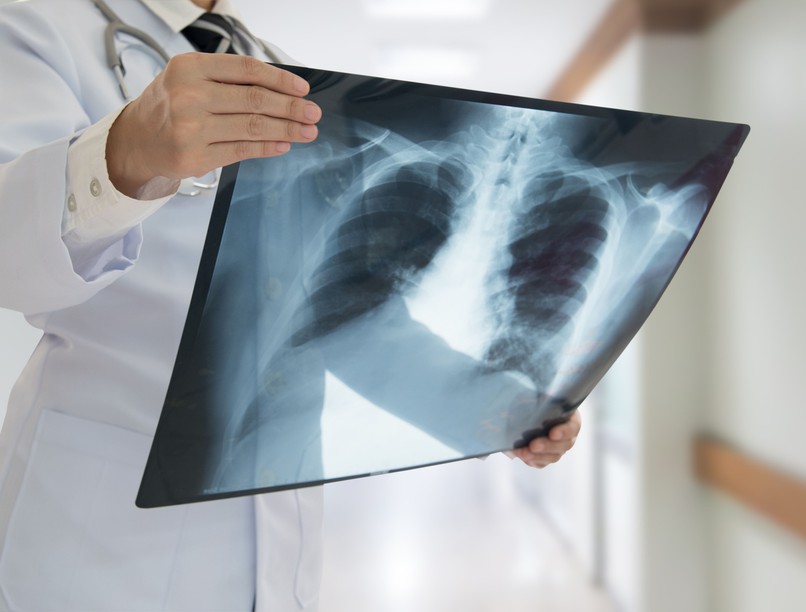 COPD, tünetmentesség, hörgőgyulladás, tüdőbetegség, légúti betegség