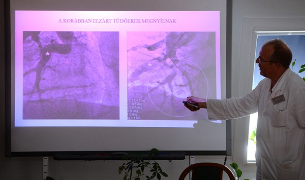 Videón mutatták be a koszorúér tágítást