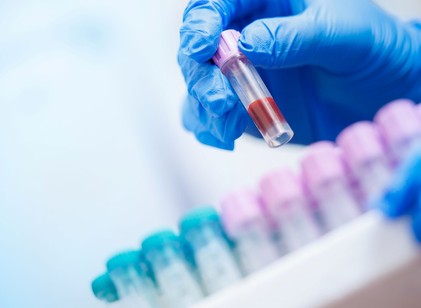 Ez a teszt sokkal többet árul el a szívéről, mint a „rossz” koleszterin szintje című cikk nyitóképe