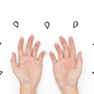 Hideg van, mégis izzad a tenyere? Nem biztos, hogy a stressz az egyetlen bűnös! című cikk nyitóképe