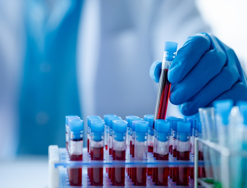 kutatás vérvizsgálat, Semmelweis Egyetemen