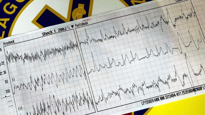 mentő, mentők, defibrillátor, sürgősségi