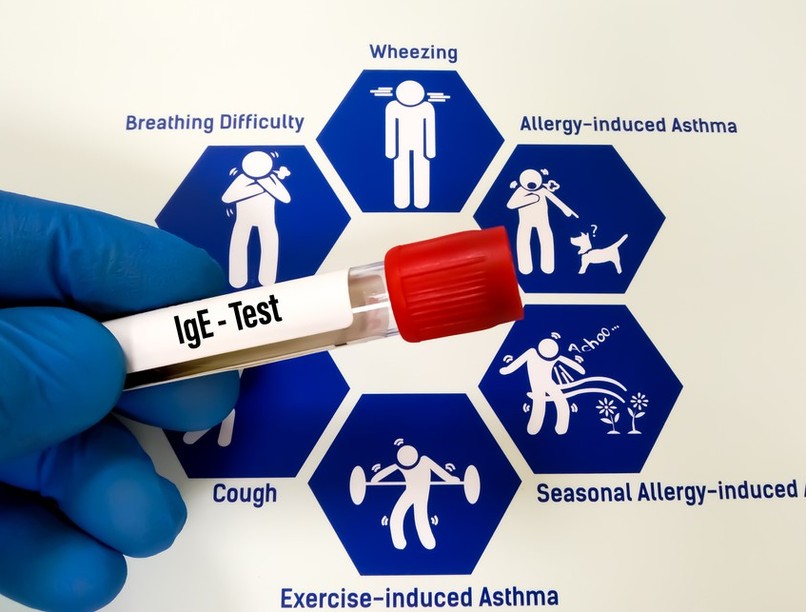 Pollenallergia, ételallergia, bőrallergia, keresztallergia, ekcéma, allergia, ige