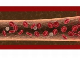 Kis orvoskalauz – mit vizsgál az angiológus?