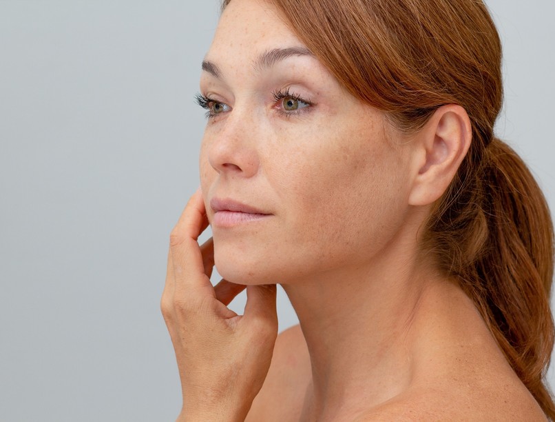 öregségi folt oka, kezelése, pigmentfolt napfolt ellen