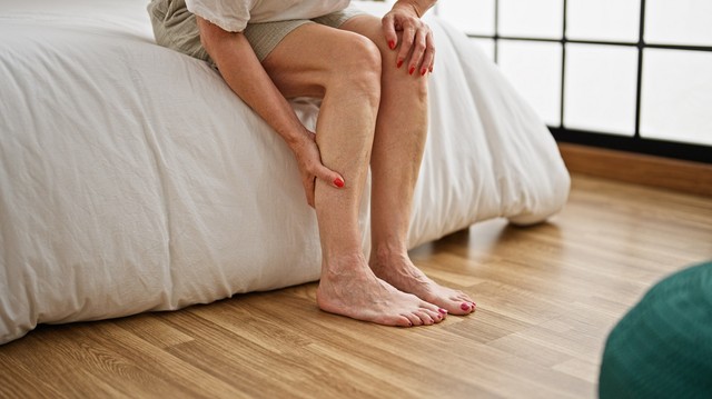 Vénás fekély: a seprűvéna és a pigmentfoltok jelenléte is előre figyelmeztethet rá