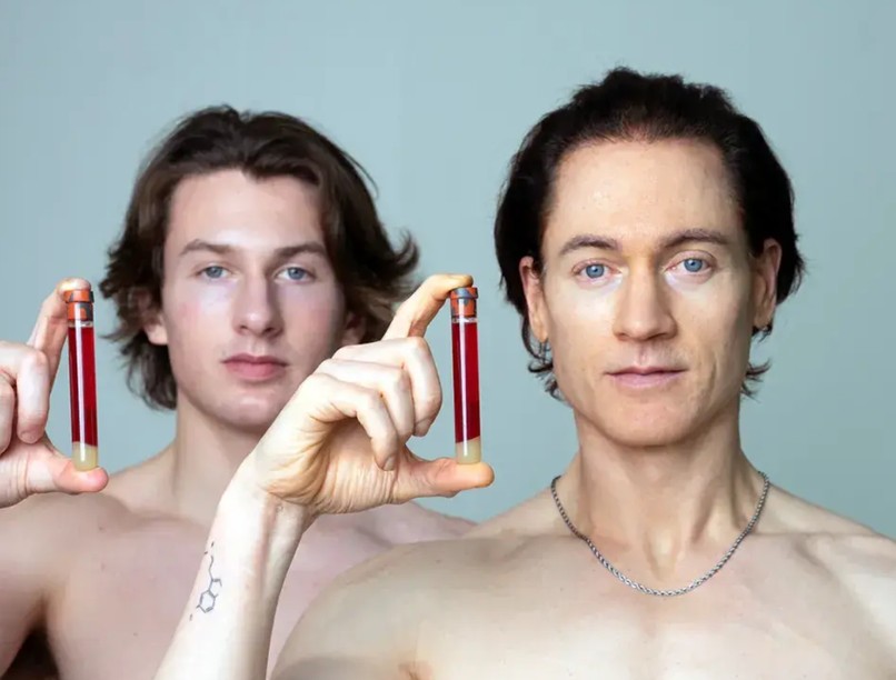 Bryan Johnson terápia életmód kísérlet