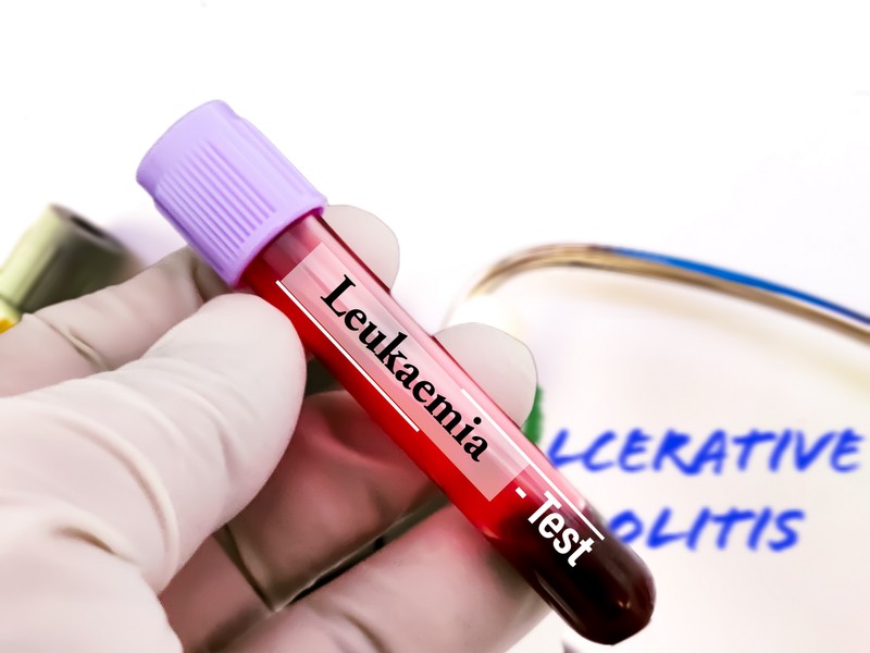 Mi a különbség az akut és a krónikus limfocitás leukémia között?