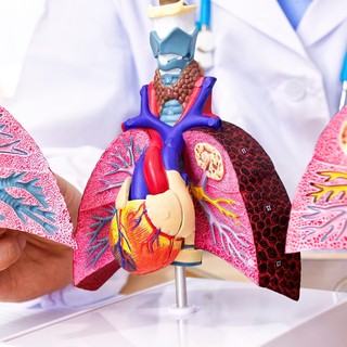 Mi a tüdőtranszplantáció (tüdő átültetés)? című cikk nyitóképe