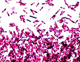 Tudományos szenzáció lehet: baktérium okozza a szklerózis multiplex betegséget?