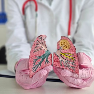 Hörghurut tünetei, vizsgálata és kezelése című cikk nyitóképe