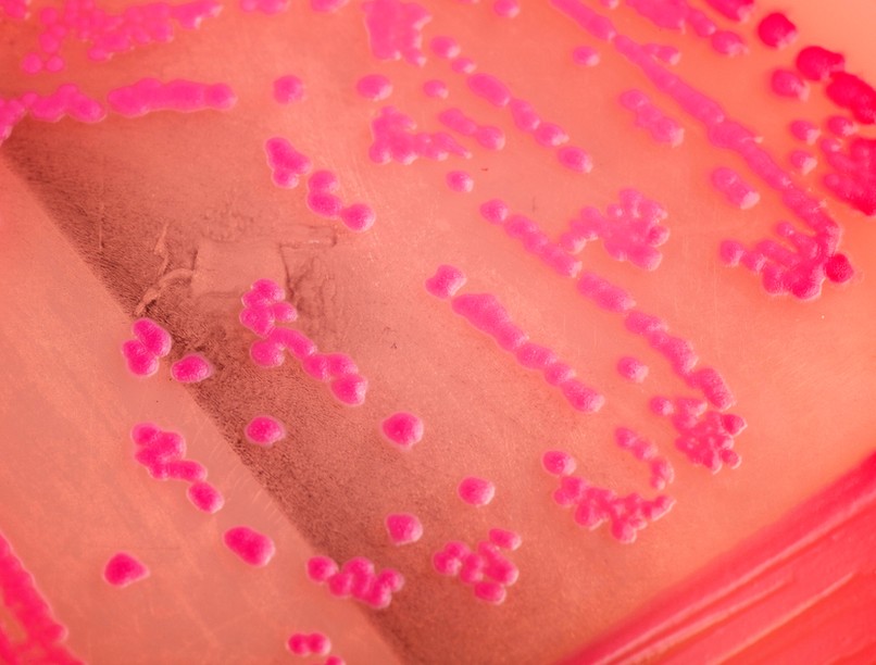 mikrobiológiai tenyésztés baktérium vírus vizsgálat leírás