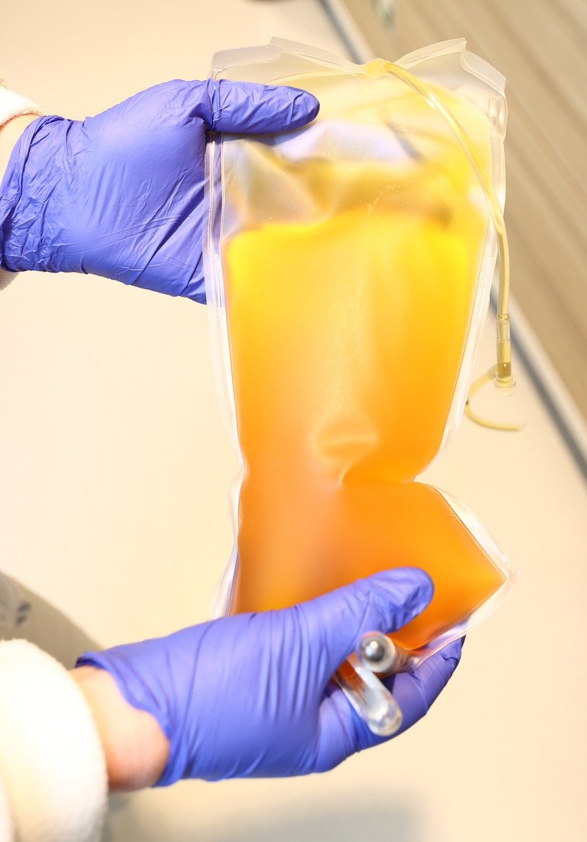 A vérplazma egy szalmasárga színű folyadék