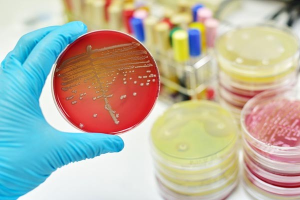 Az MRSA gyanúját a laboratóriumi vizsgálat igazolják