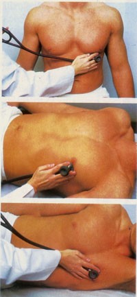 Nem meglepő, de jó tudni: 10 módszer a szívroham megelőzésére!