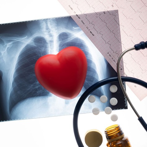 Béta-blokkolók: egy idő után abba lehet hagyni? A kutatók szerint ennyi kezelési idő is elegendő lehet szívroham után című cikk nyitóképe