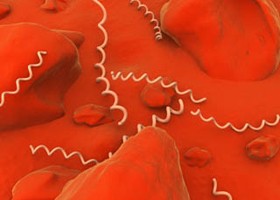 Alvászavar - és fokozott gyulladáshajlam