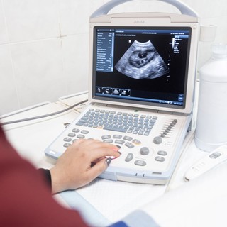 Molaterhesség (Mola hydatidosa) tünetei, vizsgálata és kezelése című cikk nyitóképe