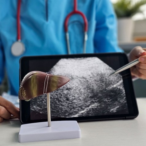 Hogyan gyógyítható a májrák? A modern onkológia valódi lehetőségei és korlátai  című cikk nyitóképe