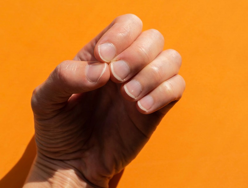 daganatos betegségek rák jele köröm