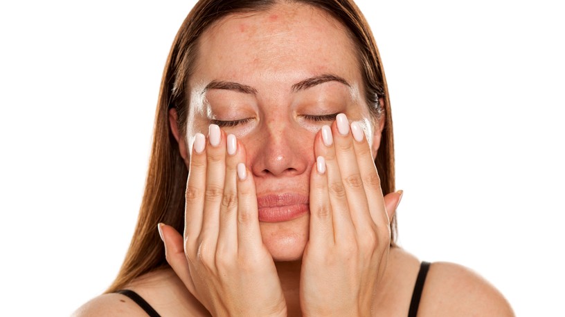 mitől pirosodik ki orr rosacea ellen