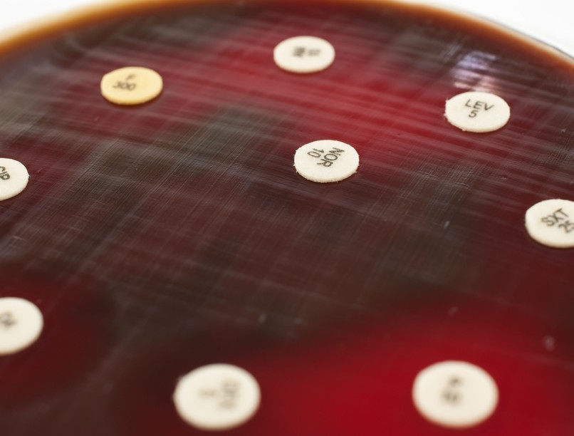 pneumococcus baktérium fertőzés