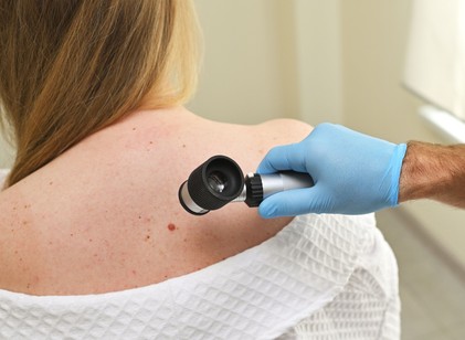 Áttörés a melanoma kezelésében: ígéretes a személyre szabott mRNS-terápia című cikk nyitóképe