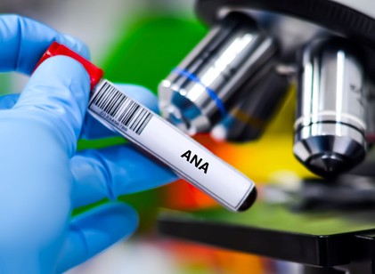 ANA teszt: mit üzen valójában ez a laboreredmény? című cikk nyitóképe