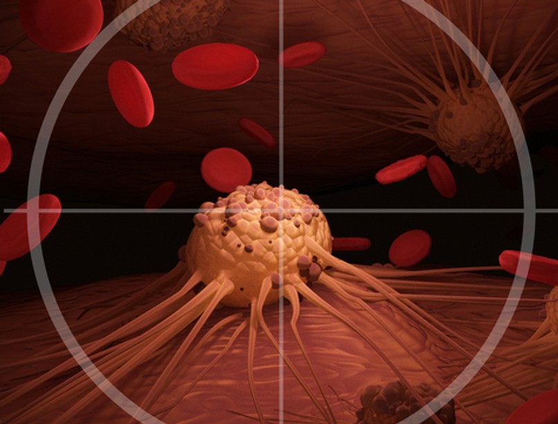 daganat terápia debrecen