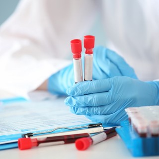 Mire utalhat az, ha csillagosak az alábbiak a vérképben? című cikk nyitóképe